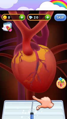 外科心脏手术截图1